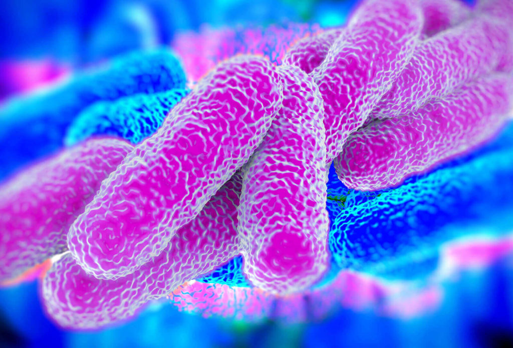 How Do You Test For Legionella
